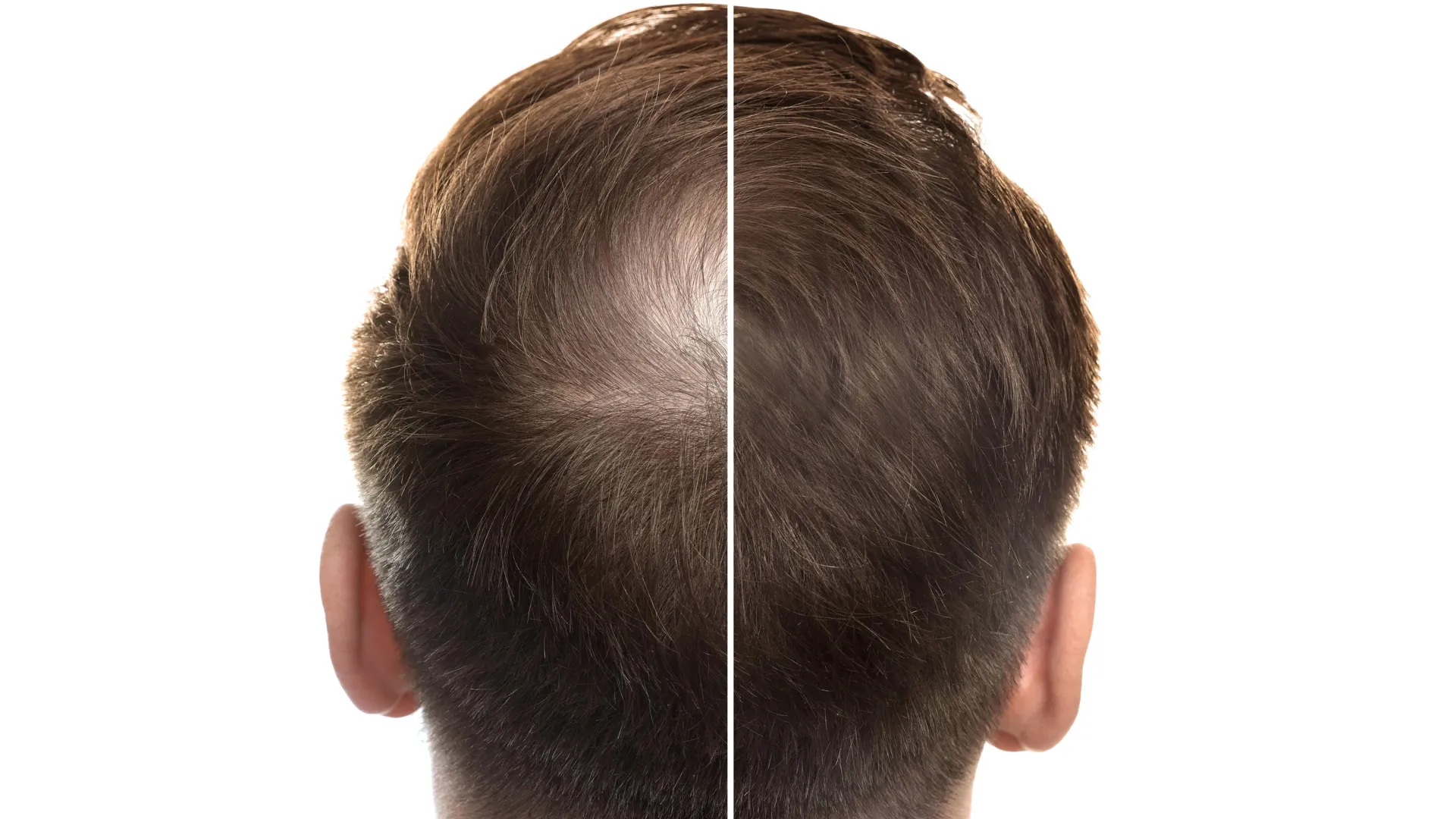Ancient Chinese Root Shows Promise Against Pattern Hair Loss