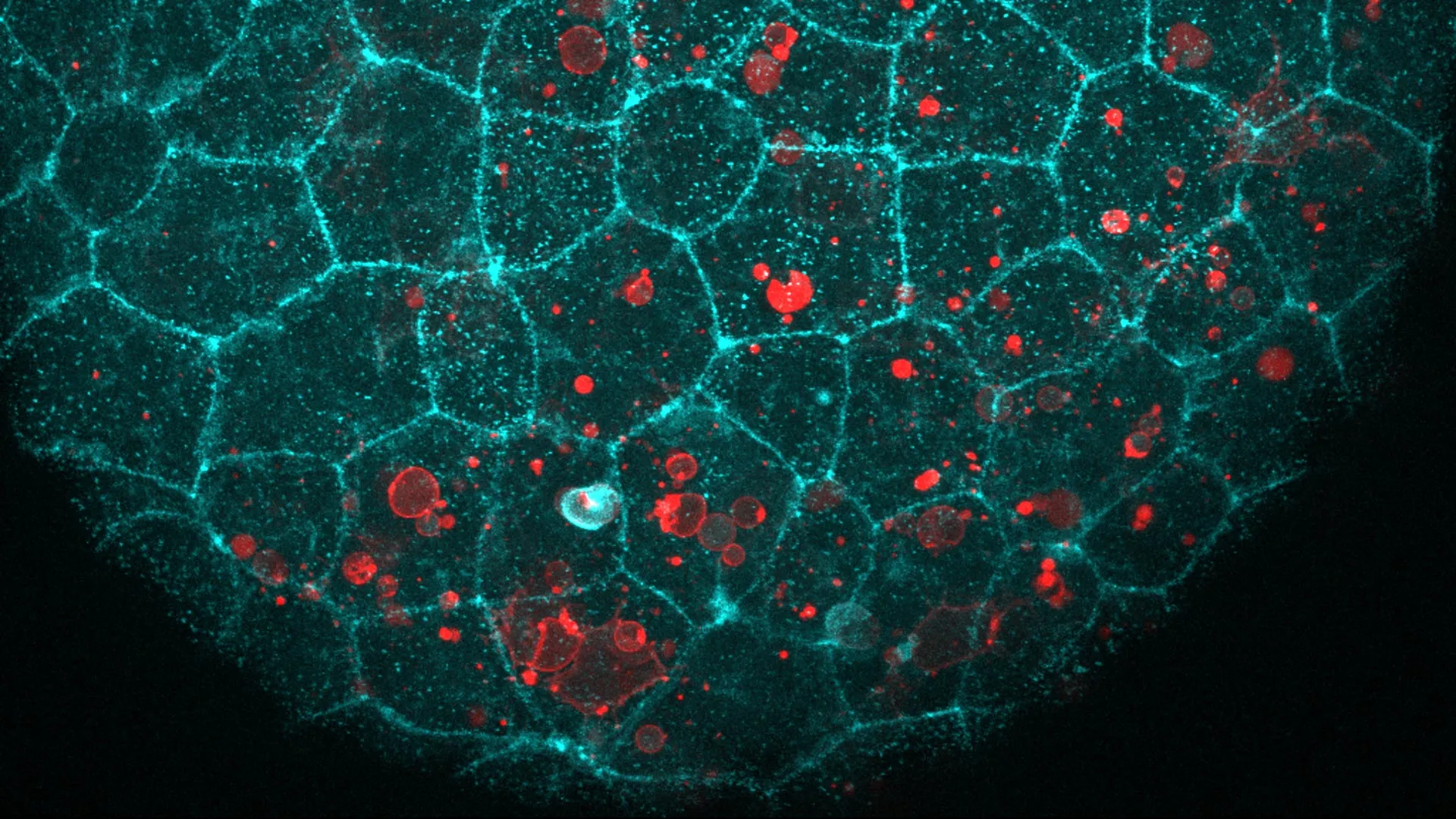 Cellular "Glue" Protein Found to Clear Dead Cell Debris