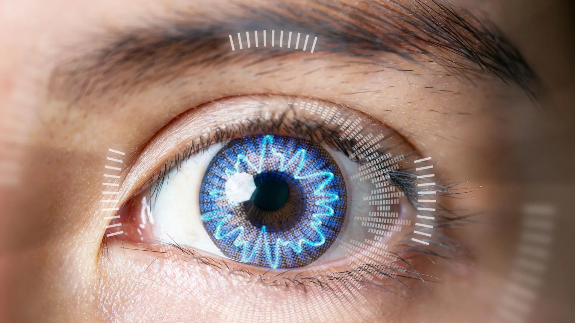 Electric Current May Reshape the Cornea Without Laser Surgery