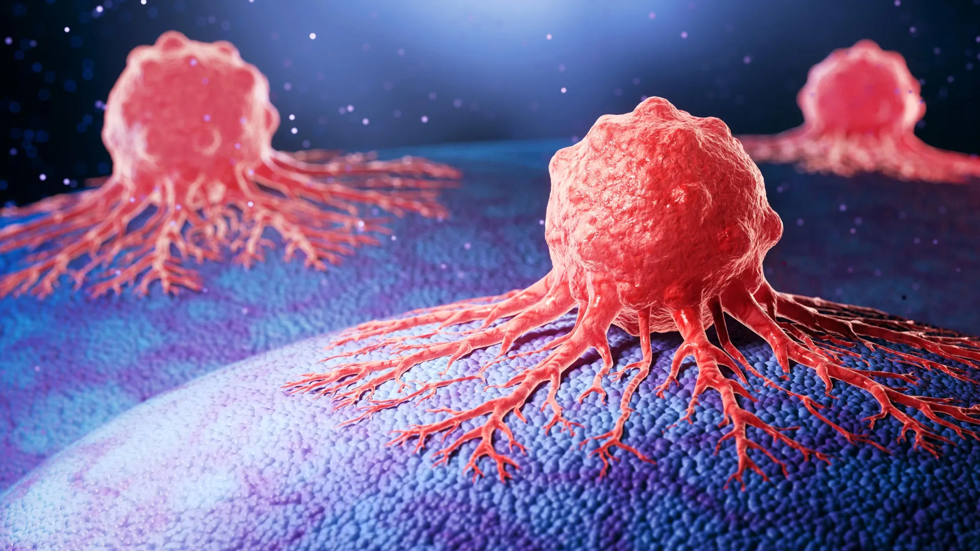Experimental Antibody May Slow Aggressive Prostate Cancer Spread