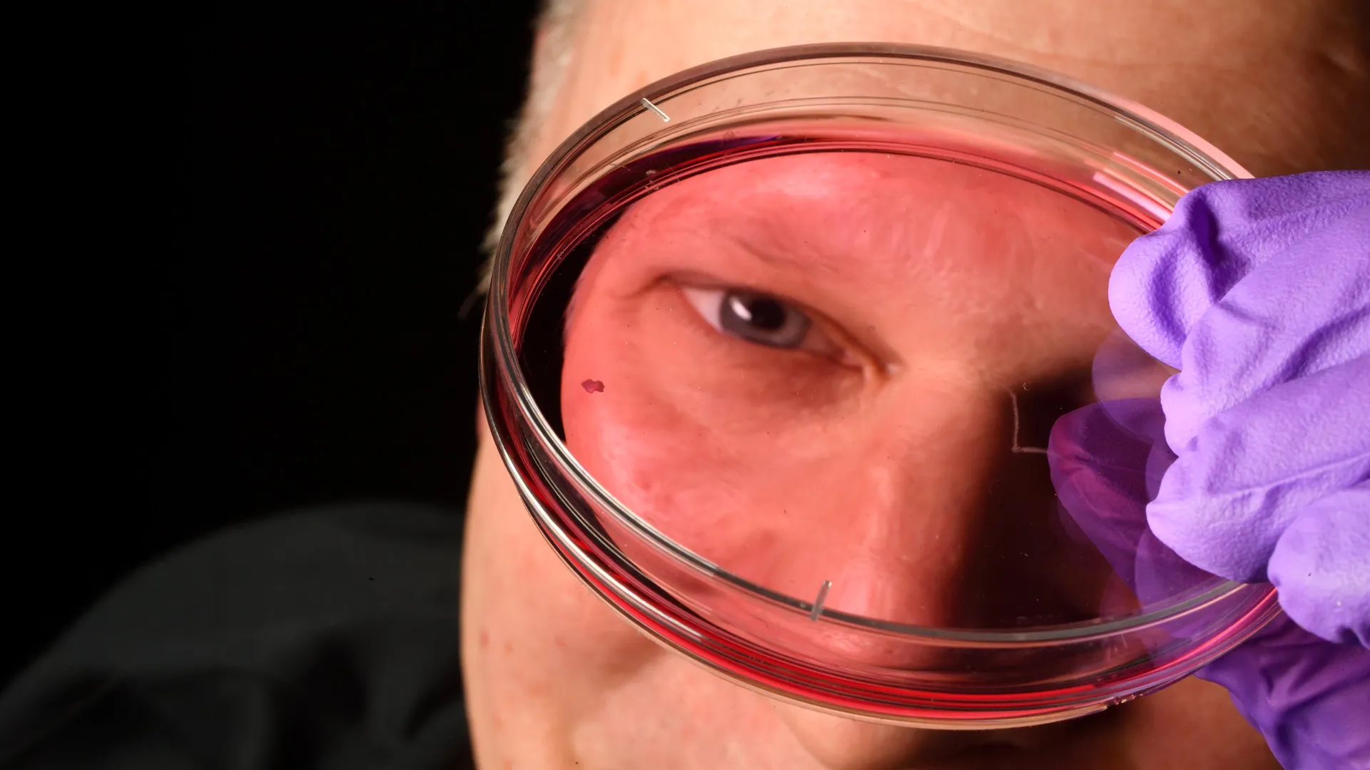 Johns Hopkins Scientists Uncover How Sharp Central Vision Forms Before Birth